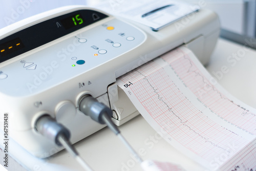 Cardiogram of the baby before birth