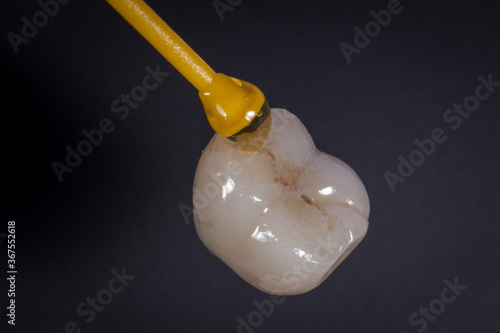 Dental Art, Smile design, Teeht