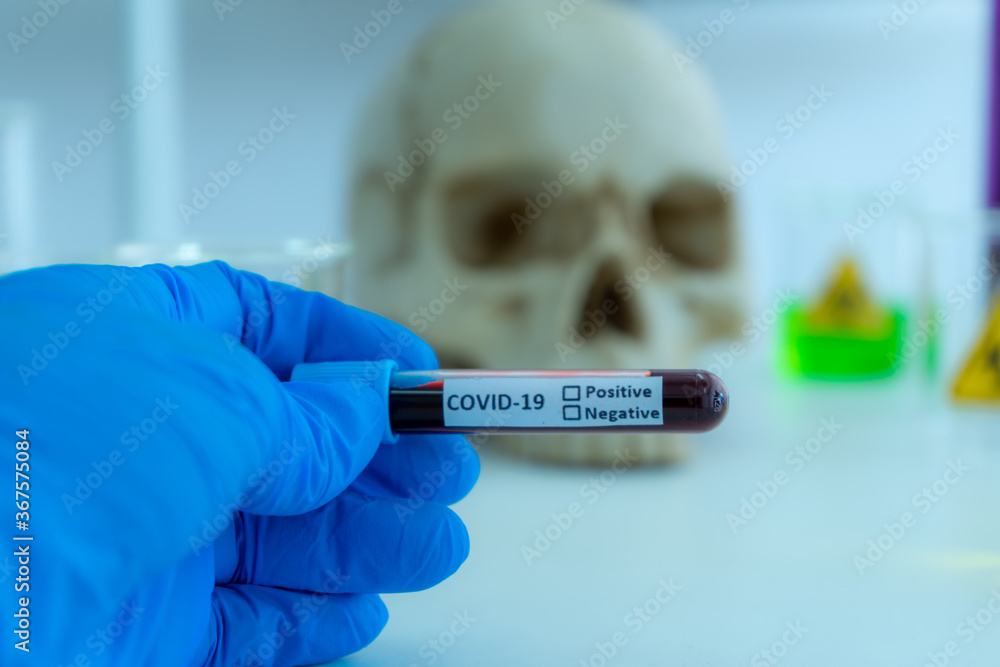blood sample in test tube galssware in science laboratory equipment to diagnosis for virus pandemic blood sample in test tube galssware in science laboratory equipment to diagnosis for virus pandemic