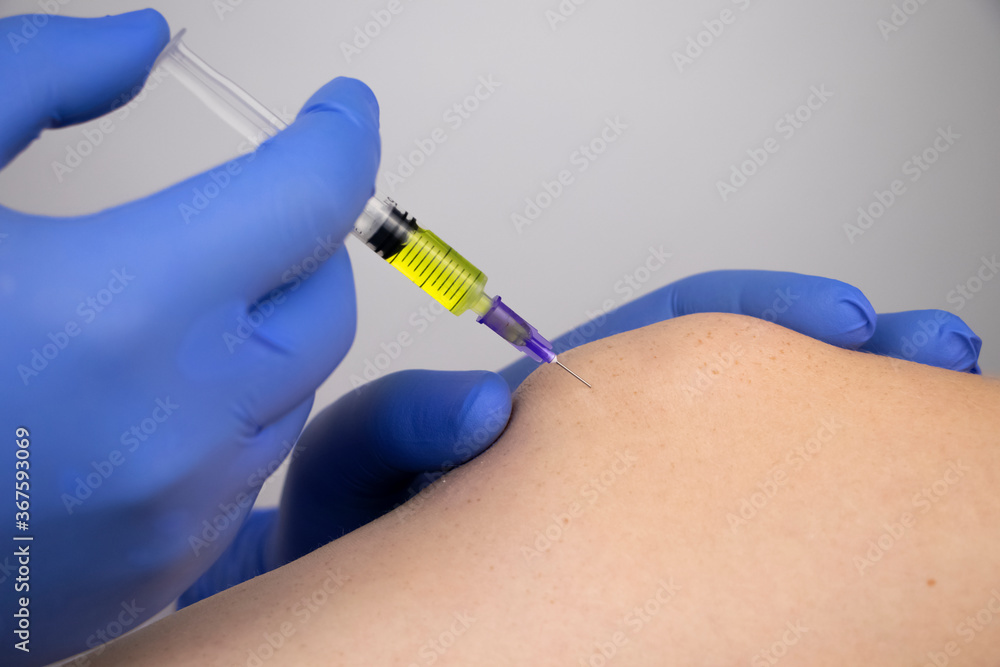 An orthopedic surgeon gives an injection in the knee. Treatment of osteoarthritis with hormonal drugs or drugs based on hyaluronic acid. Help with diseases that damage the cartilage of the joint An orthopedic surgeon gives an injection in the knee. Treatment of osteoarthritis with hormonal drugs or drugs based on hyaluronic acid. Help with diseases that damage the cartilage of the joint