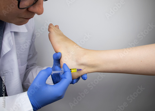An orthopedic surgeon injects medicine into the Achilles tendon to relieve pain. Help treat sprains, trauma or injury.