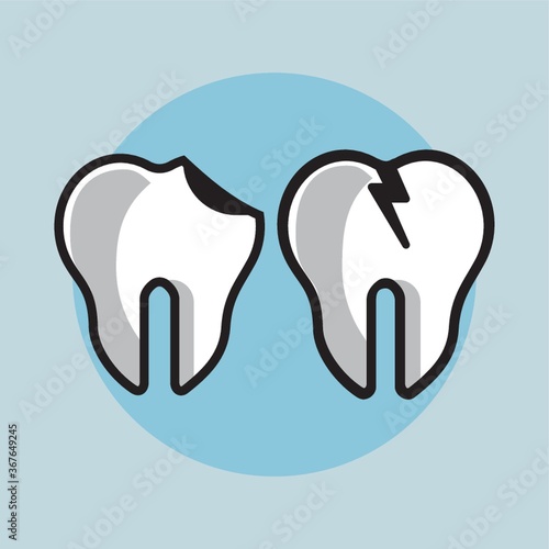 tooth with cavity