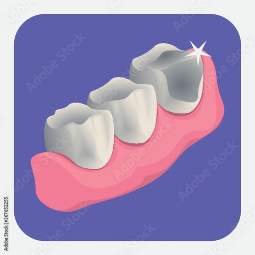 teeth with cavity