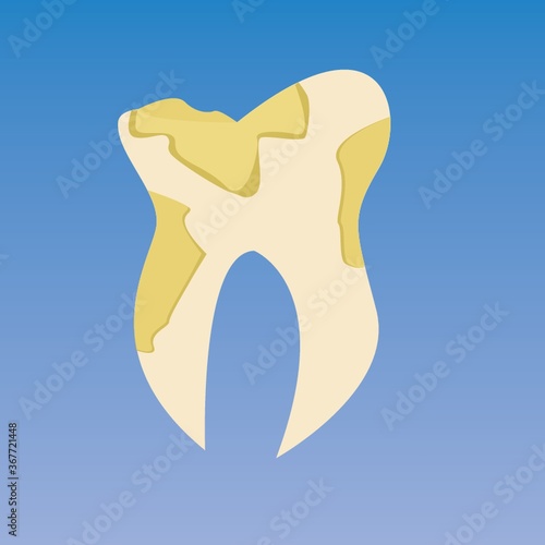 tooth with cavity