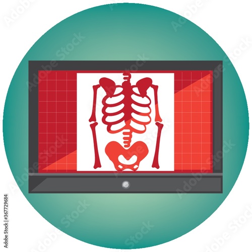 x ray on monitor