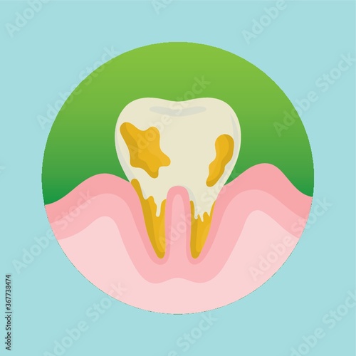 tooth with cavity