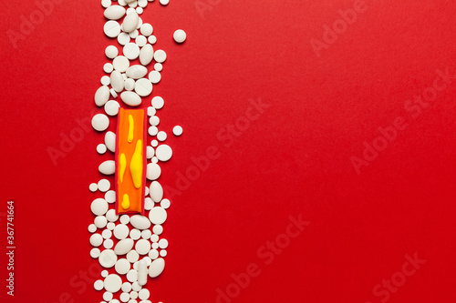 Photography Atherosclerosis disease, narrowing of arteries due to plaque buildup on artery walls