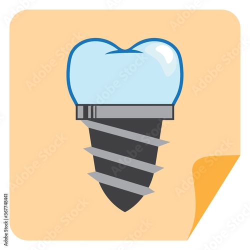 screw on false tooth denture