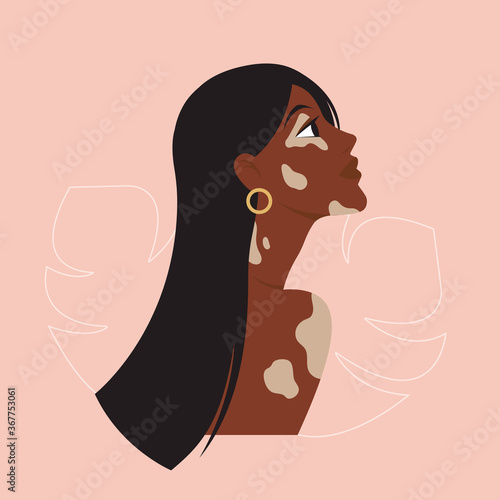 Profile portrait face young beauty african american woman with vitiligo skin and leaf monstera and earring. Vector isolated flat illustration. Avatar of a afro silhouette girl. 