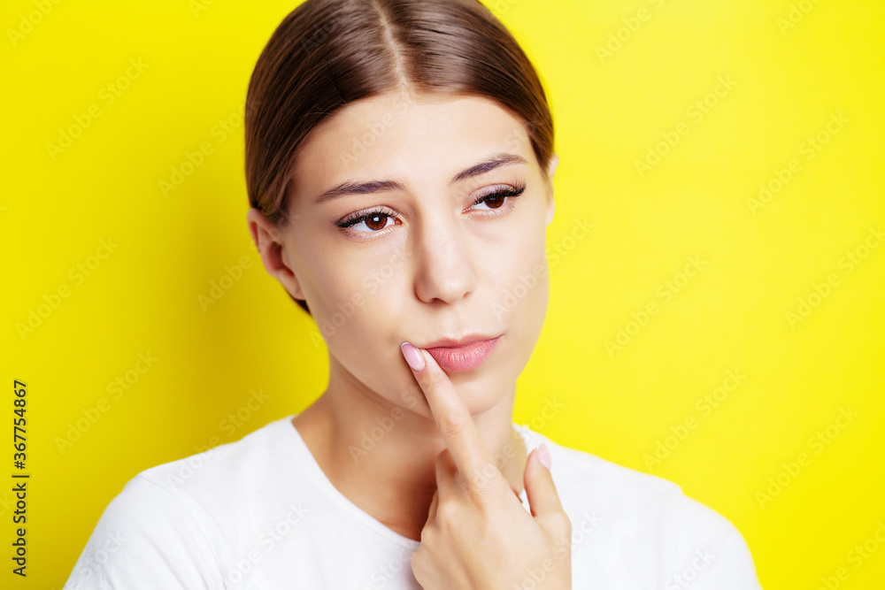 Young woman has cold sores on her lips Young woman has cold sores on her lips