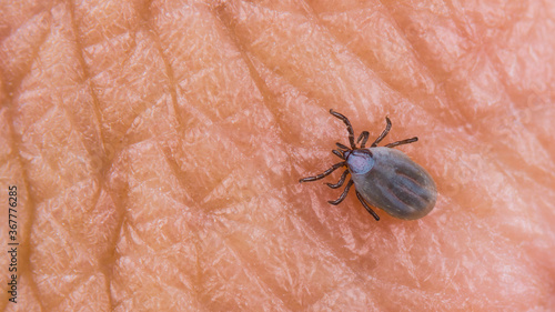 Small female deer tick on human skin texture. Ixodes ricinus or scapularis. Parasitic mite close-up. Fat body full of blood and visible hypostom piercing into epidermis. Encephalitis or Lyme disease.