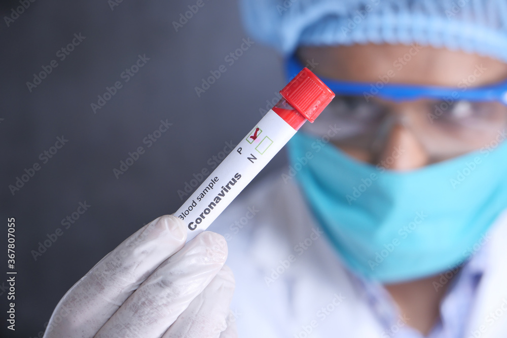 laboratory technician testing corona virus , COVID 19 test. laboratory technician testing corona virus , COVID 19 test.