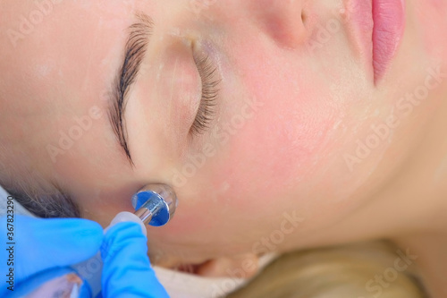 Microcurrent face treatment with hyaluronic acid gel for young woman in beauty clinic, top view. Beautician doctor moving manipula around eyes. Apparatus hardware procedure in cosmetology.