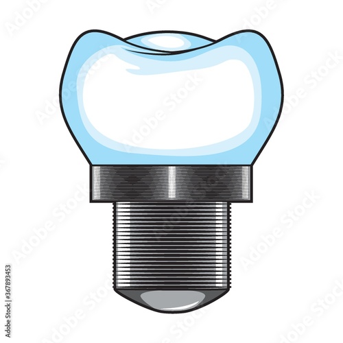 tooth implant