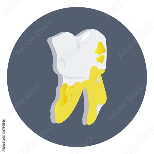 tooth plaque