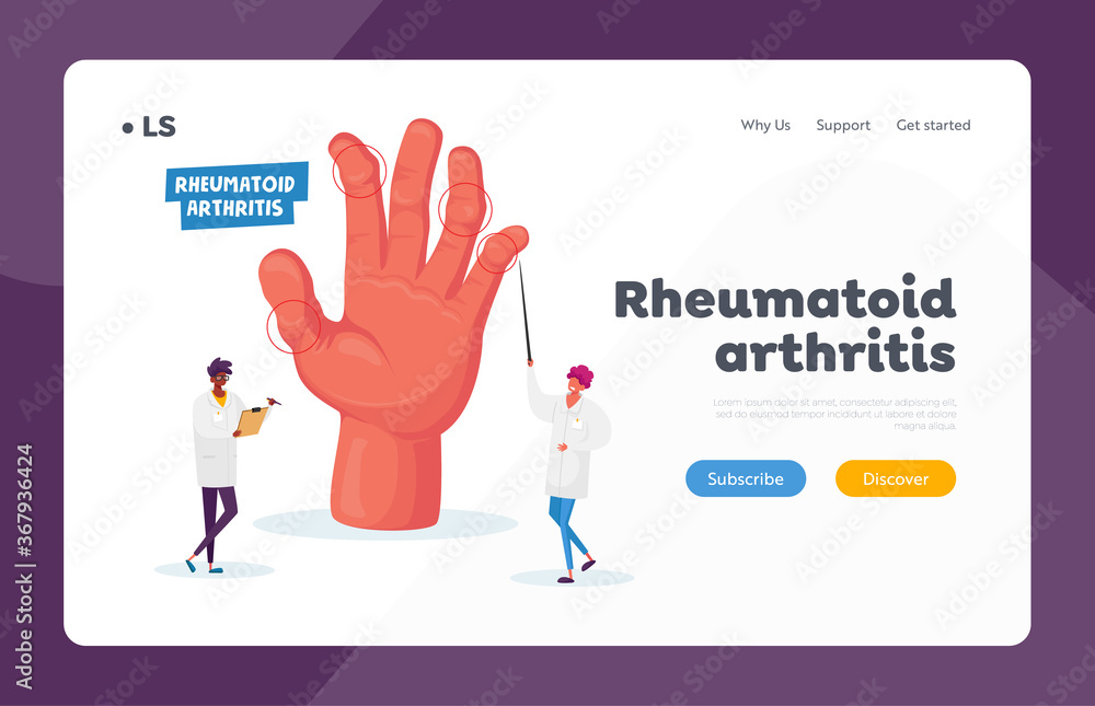 Rheumatoid Arthritis Landing Page Template. Doctor Arthrologist Pointing on Hand with Joints Disease, Medical Concilium Rheumatoid Arthritis Landing Page Template. Doctor Arthrologist Pointing on Hand with Joints Disease, Medical Concilium