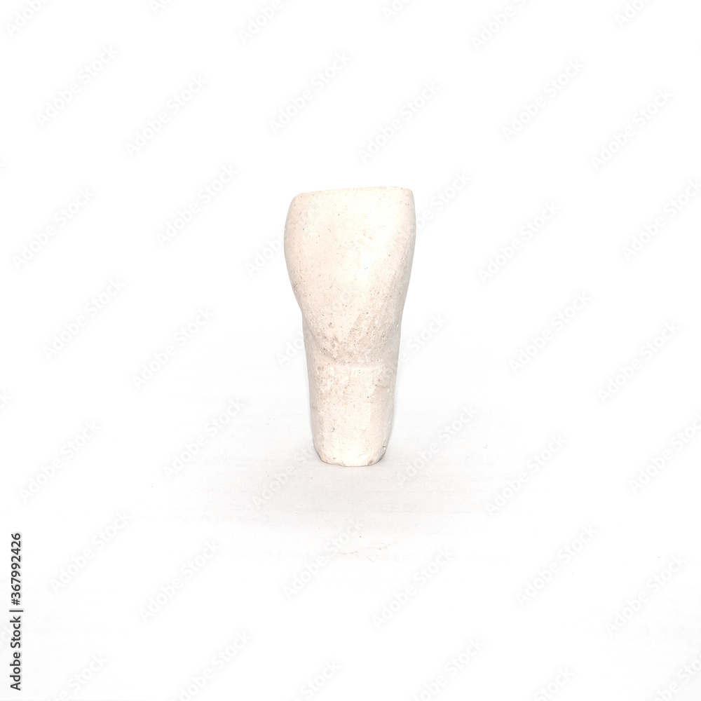 Plaster model of maxillary lateral incisor tooth Stock Photo | Adobe Stock