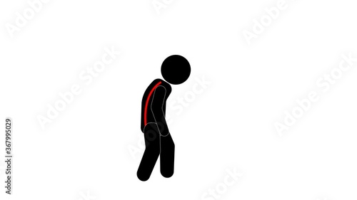 man walks with wrong posture. aligns and goes with correct posture. flat design. video illustration.