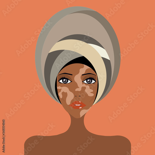 Created with  portrait of african woman with vitiligo, turban in hair, beauty © CELINE