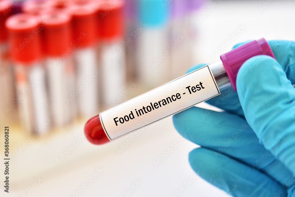 Obraz premium Test tube with blood sample for food intolerance test