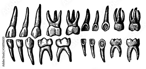 Twenty Temporary Teeth, vintage illustration.