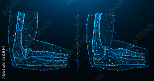 Blue polygonal illustration of the elbow joint, lateral and medial view.