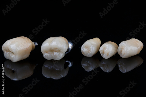 excellent composition of ceramic crowns of chewing teeth, on black glass