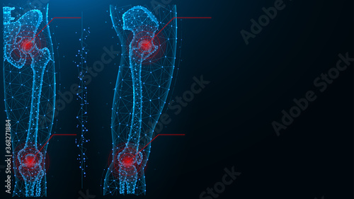 Pain in the hip and knee joint blue polygonal vector illustration