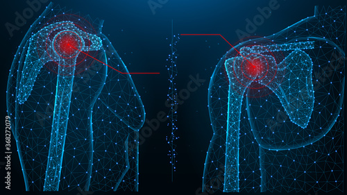 Shoulder joint pain blue polygonal vector illustration