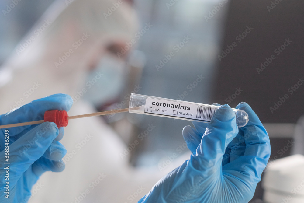 A scientist examining a smear sample in a test tube with a sticker displaying coronavirus positive and negative checkboxes..... A scientist examining a smear sample in a test tube with a sticker displaying coronavirus positive and negative checkboxes.....
