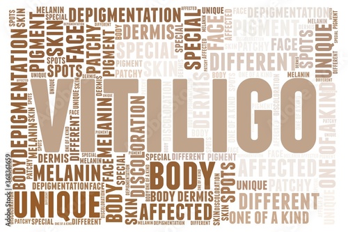 Vitiligo skin depigmentation word cloud isolated on a white background