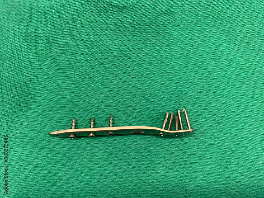 explanted titanium plate with screws from an ankle fracture lies on a