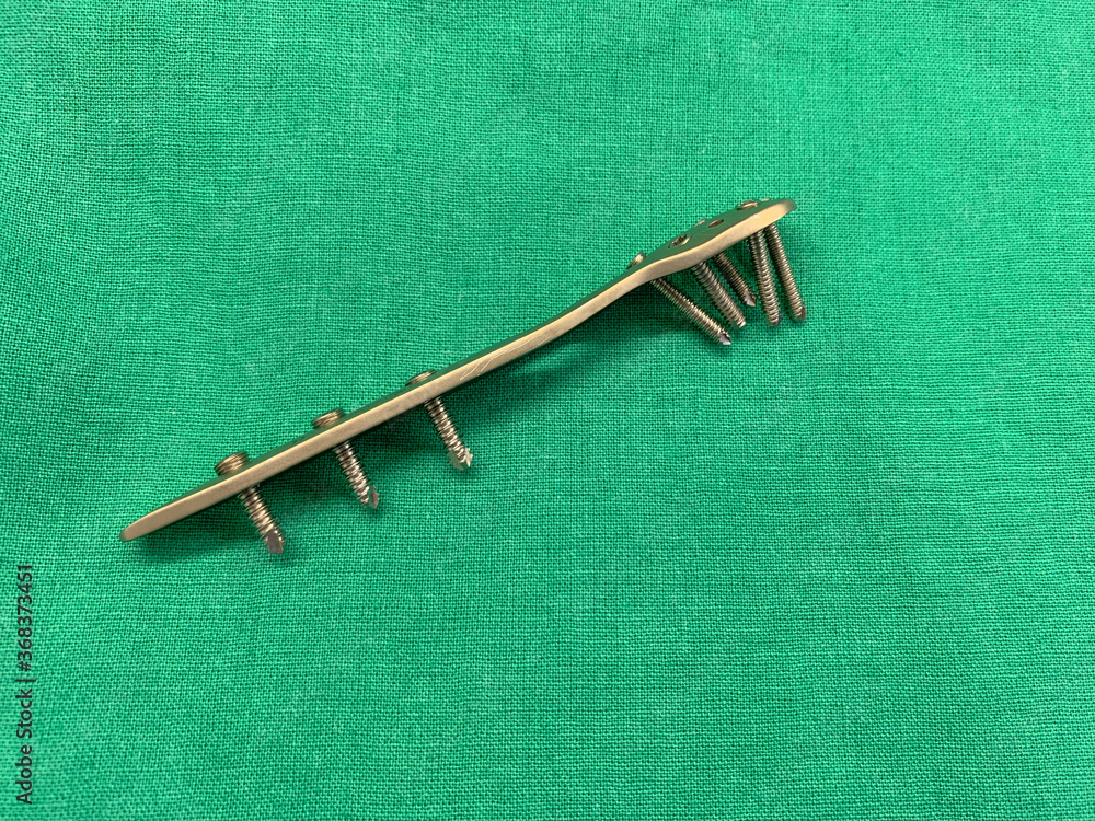 explanted titanium plate with screws from an ankle fracture lies on a