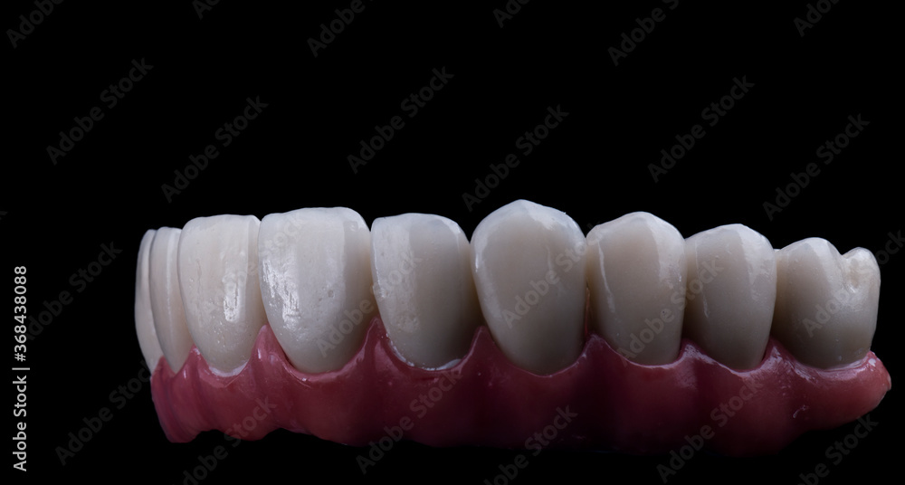 Obraz premium ceramic crowns done on 8 implants