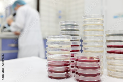 Selective focus of stack of petri dish with blurred male scientist working on a microscope on a microbiology laboratory background. photo