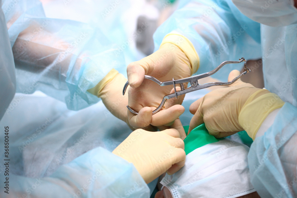 The dentist and assistant prepare the oral cavity for the removal of deep caries from the baby tooth. The view from the top. Copy of the space. Unrecognizable photo. The dentist and assistant prepare the oral cavity for the removal of deep caries from the baby tooth. The view from the top. Copy of the space. Unrecognizable photo.