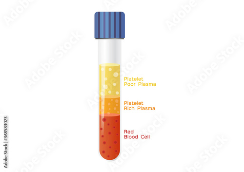 Platelet-Rich plasma procedure stages / prp / Centrifuge vector