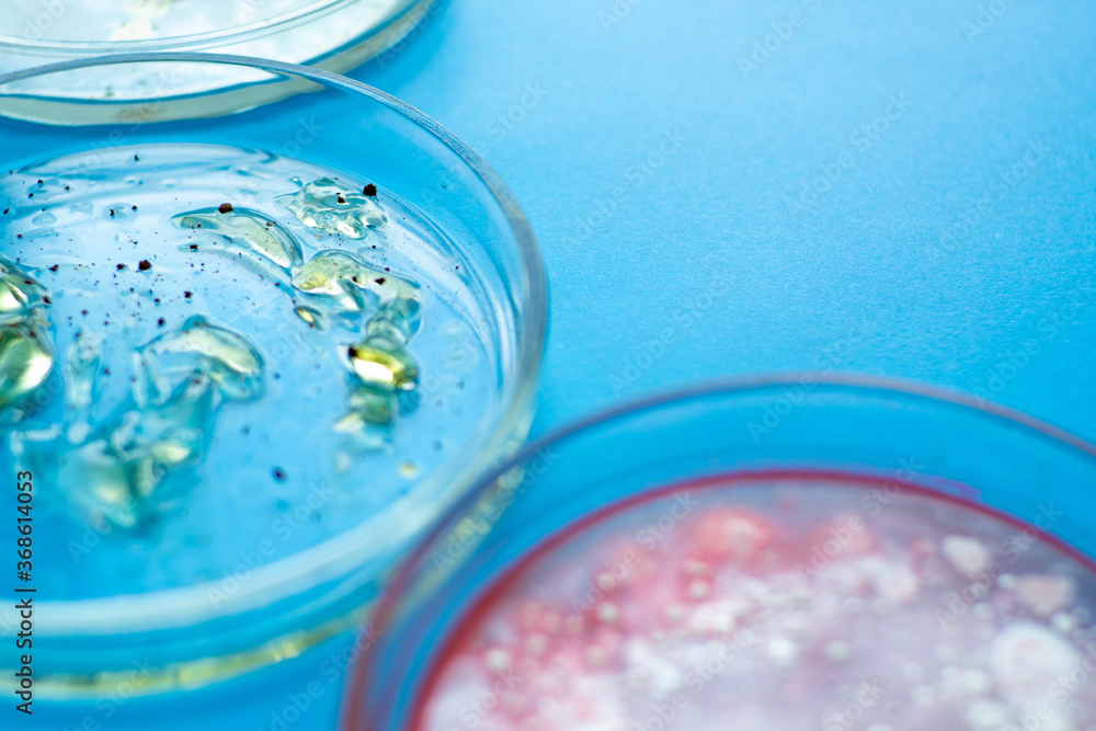 Viruses and bacteria in a Petri dish, various analyses in the laboratory. Virology and virus research, concept. Viruses and bacteria in a Petri dish, various analyses in the laboratory. Virology and virus research, concept.