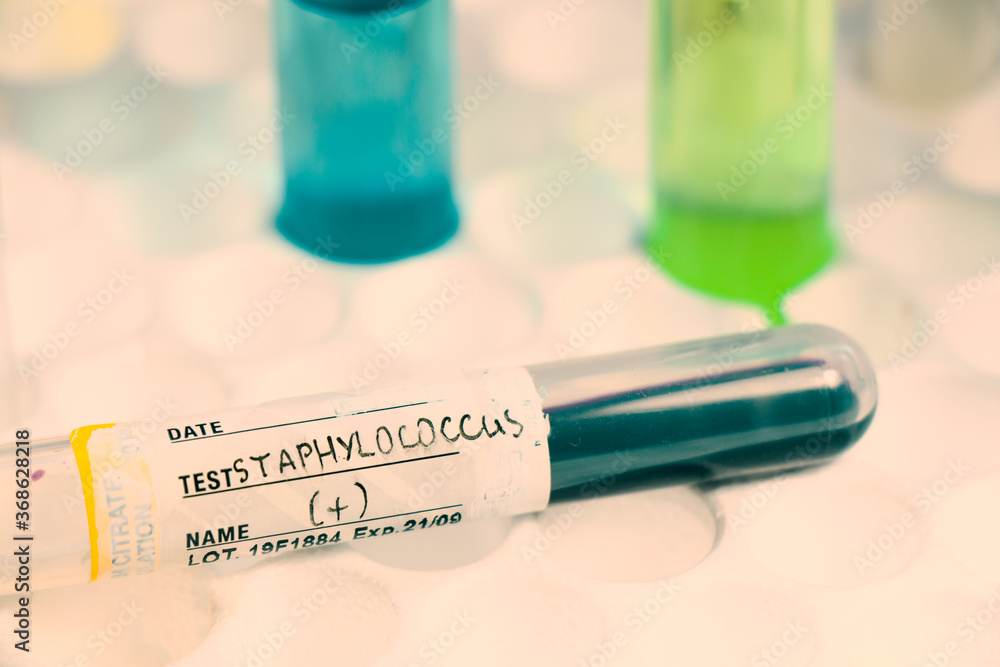 Staphylococci bacteria, blood test tube samples, laboratory and chemical liquid elements, cocci