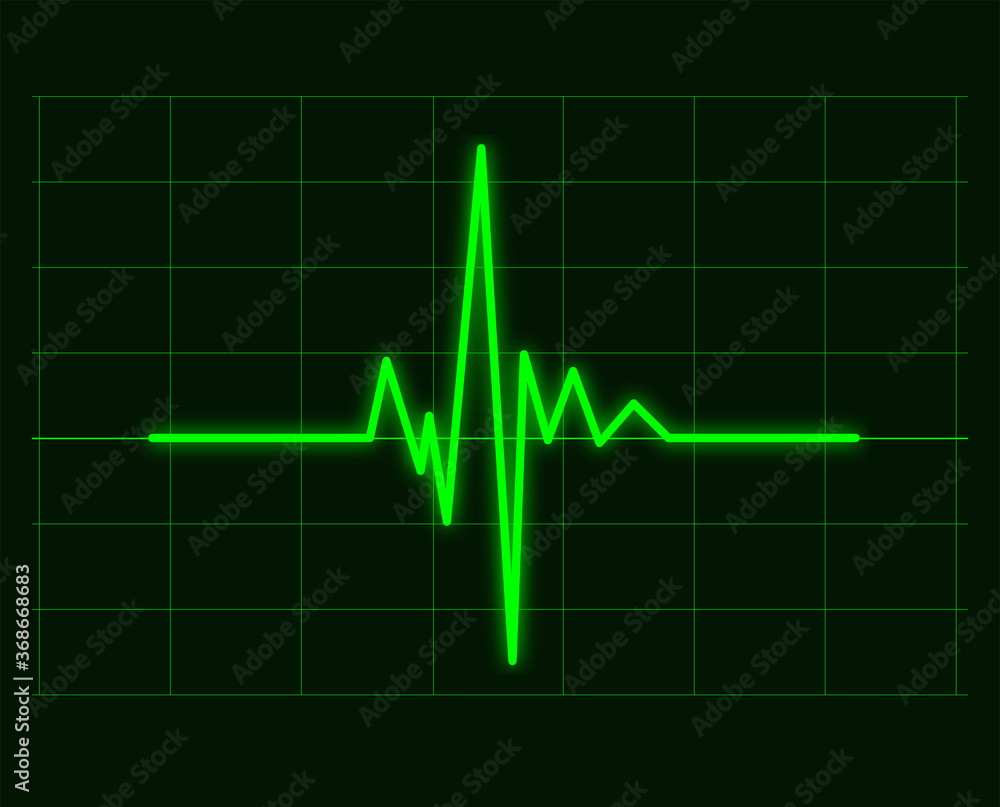Green cardiac waveforms of heart cardiogram Green cardiac waveforms of heart cardiogram