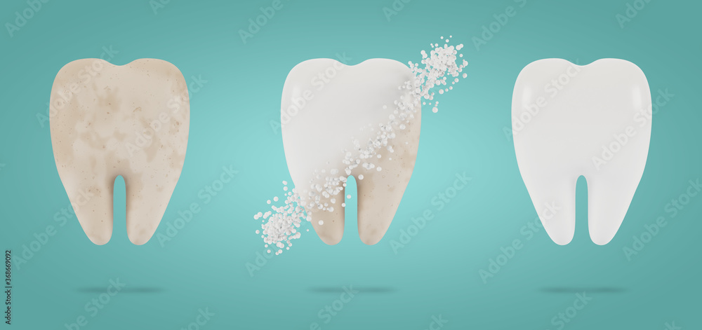 Tooth whitening. The concept of dental examination of teeth, dental health and hygiene. 3D illustration. Tooth whitening. The concept of dental examination of teeth, dental health and hygiene. 3D illustration.