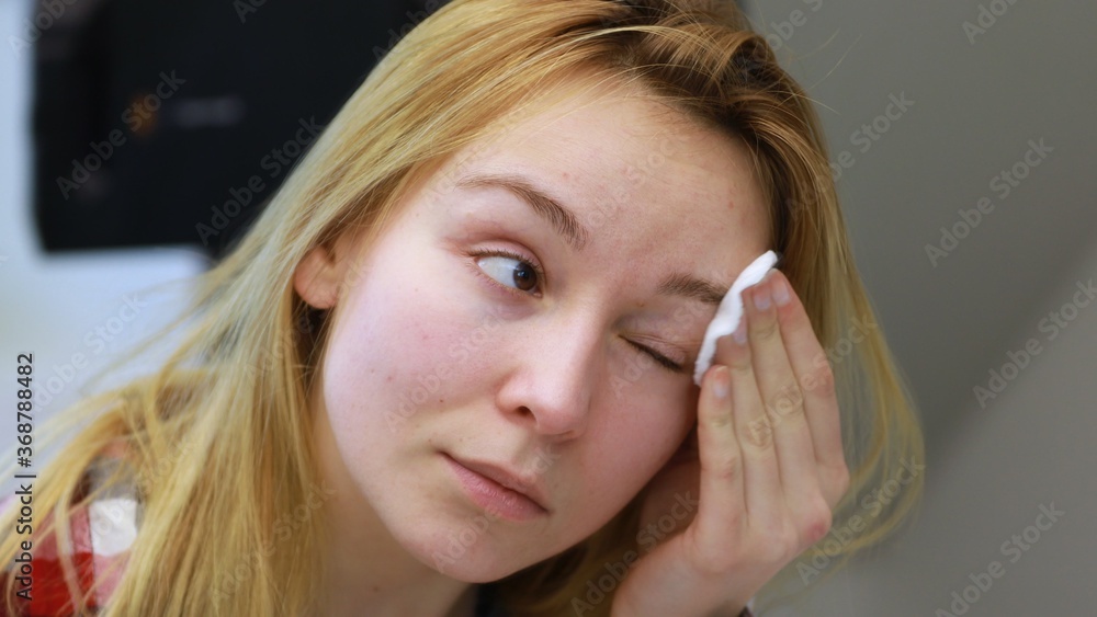 beautiful girl cleans the face of makeup with a cotton pad