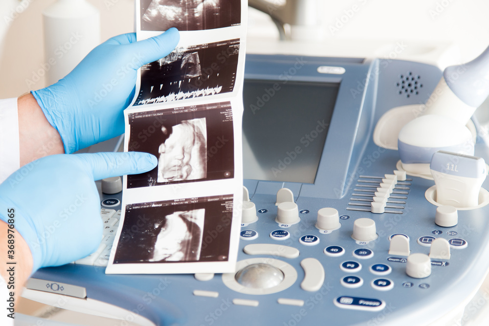 Lekarz ginekolog trzyma w ręku zdjęcie usg. Klinika ginekologiczna.  - obrazy, fototapety, plakaty 