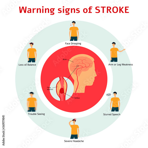 Stroke warning signs - flat cartoon infographic of man showing symptoms of medical health issue