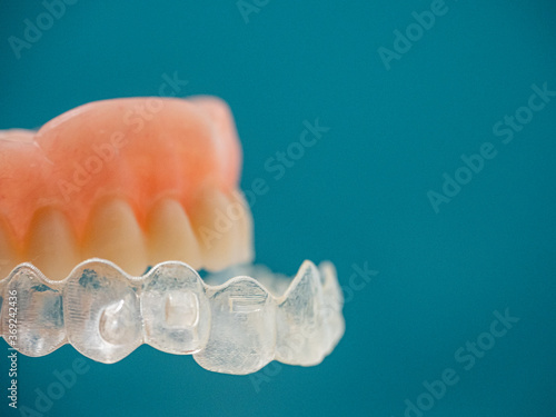 A DENTURE FITTING THE INVISALING BRACES ON A BLUE BACKGROUND photo