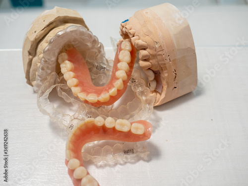 DENTURES, MOLDS, INVISALING AND DIFFERENT DENTISTS' OBJECTS ON A WHITE BACKGROUND photo