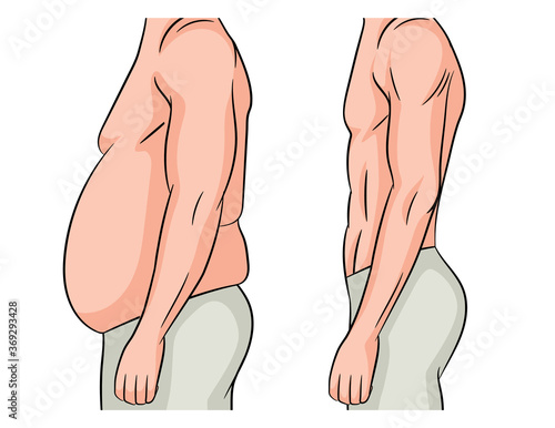 Color vector illustration isolated on white background. Man before and after losing weight. Male body transformation. The man lost extra pounds and lost weight at the waist.
