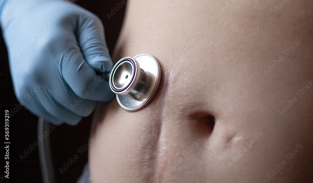 Fototapeta premium Stethoscope and scar on human skin