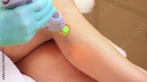 Wallpaper Mural Laser hair removal with a modern device on the arm and leg of a young and beautiful woman. Hair removal by laser surgery Torontodigital.ca