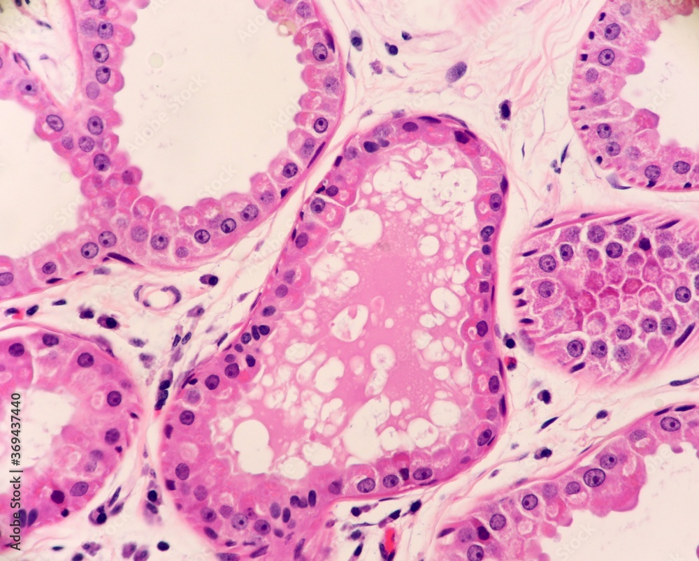 Fototapeta premium Apocrine sweat glands from the underarm or axilla area containing secretions. Microscopic view.